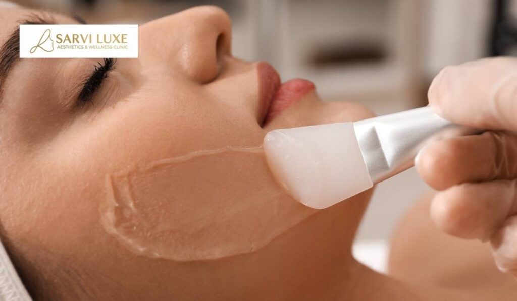 Chemical peel treatment being applied on a patient's face at Sarvi Luxe clinic in Ashok Vihar, Delhi