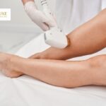 Laser hair reduction treatment in Ashok Vihar at Sarvi Luxe