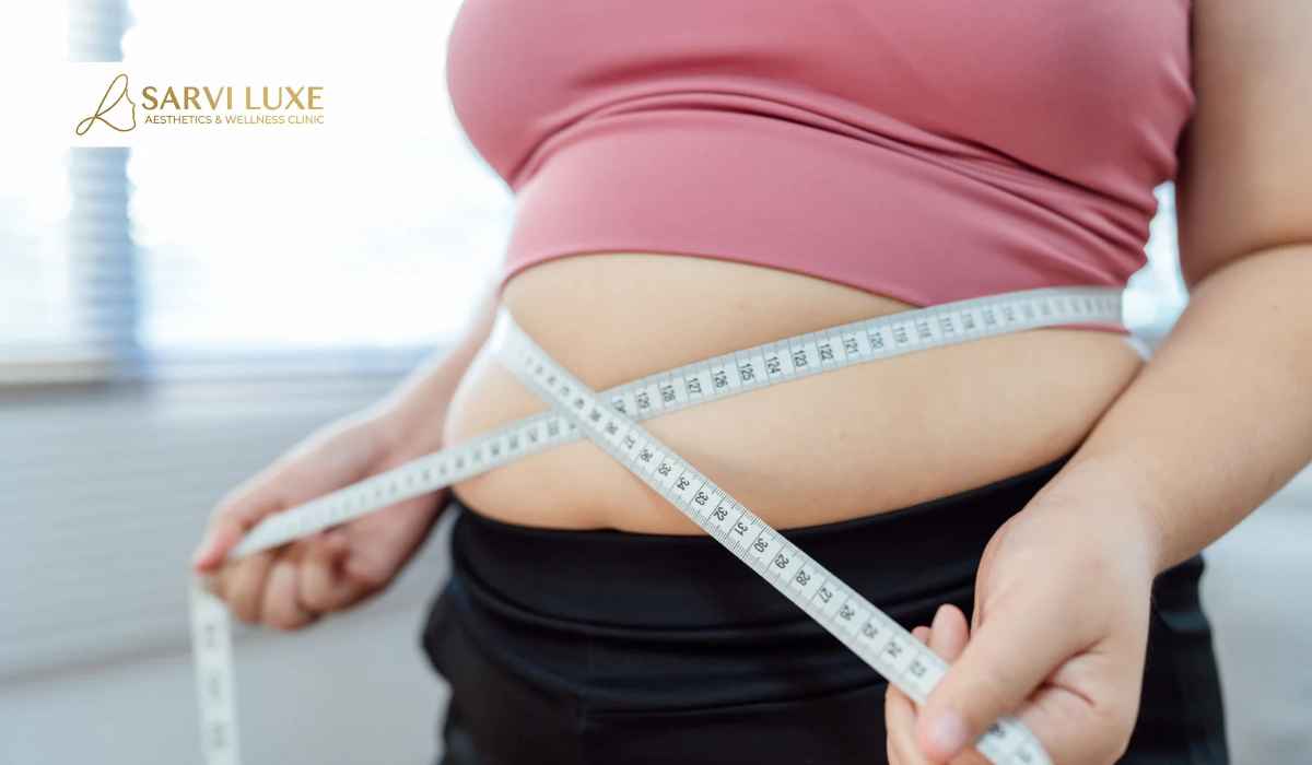 Tummy fat reduction consultation at Sarvi Luxe in Ashok Vihar